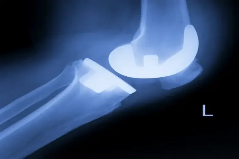 Chirurgie orthopédique Riaz et Montreux